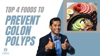 Foods that prevent polyps colon edition [upl. by Nnaasil966]