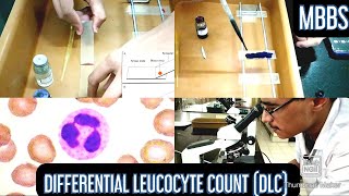 Differential Leucocyte Count DLC Practical  MUHS  mbbs physiology hematology [upl. by Vaenfila]