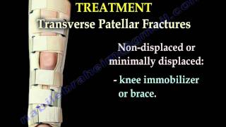 Patellar Fractures  Everything You Need To Know  Dr Nabil Ebraheim [upl. by Lenrad]