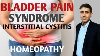 Interstitial Cystitis  मूत्राशय में दबाव और दर्द होना  Bladder Pain  Homeopathic Treatment [upl. by Snahc]