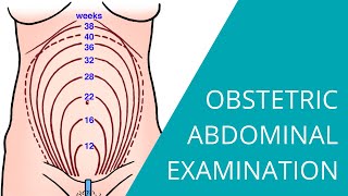 Obstetric Abdominal Examination  Steps for examining a pregnant woman [upl. by Denney]