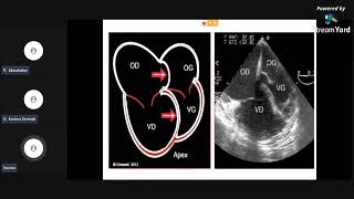 meilleure explication de🤩 Embolie pulmonaire🤩Pr FOUAD cardiologie pneumologie résidanat EVC ECN [upl. by Dionysus944]