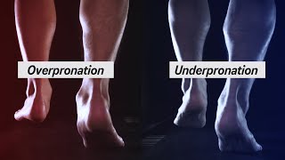 How to Determine your Pronation [upl. by Seessel]