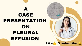 case presentation on pleural Effusion pleuraleffusion casepresentation subscribe nursingstudent [upl. by Ailyt]