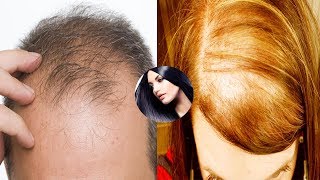 Hair Treatment At Home  DIY Black Seed Oil And Honey For Hair Growth And Baldness [upl. by Gordie]