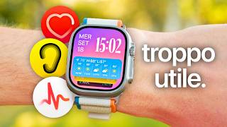 Ecco PERCHÉ ti SERVE DAVVERO un APPLE WATCH nel 2024 🔥⌚️ [upl. by Trevorr]