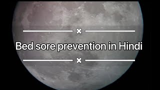 Bed sore  Pressure ulcers Decubitus ulcer Prevention explained in Hindi [upl. by Carisa]