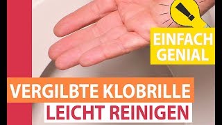 Vergilbte Klobrille leicht reinigen Toilettensitz von gelb nach weiß [upl. by Netsriik]