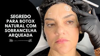 RUGAS TRAVADAS E SOBRANCELHA ARQUEADA COM BOTOX Sem pálpebra caída [upl. by Munsey]