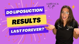 How long will liposuction results last [upl. by Chesna]