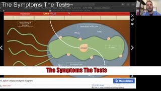 How Do You Know If You Have Helicobacter Pylori [upl. by Aronel292]