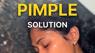 Complete pimple solution [upl. by Alexine]