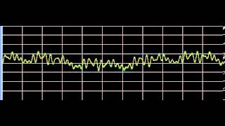 Melanosis  Rife Frequencies [upl. by Remas]