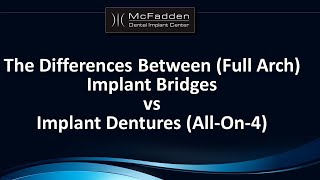 Implant Bridges vs Implant Dentures AllOn4 [upl. by Il]