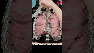 The Truth About Incentive Spirometry Doctor Explained [upl. by Pickens]