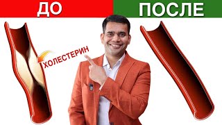 4 Совета По Очистке Артерий И Сосудов  Декальцинация Артерий И Сосудов [upl. by Sinnoda370]