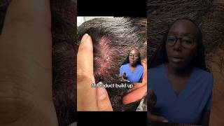 10 Causes of ITCHY Scalp [upl. by Nnairak]