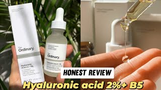 The Ordinary Hyaluronic acid 2 B5 Honest Review [upl. by Gerita]