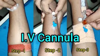 IV Cannulation Step by Step kaise lagaye  Veinflow kaise lagaye iv cannula fixation GNM Nursing [upl. by Finn]