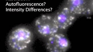 Fluorescence In Situ Hybridization FISH Review [upl. by Suchta959]