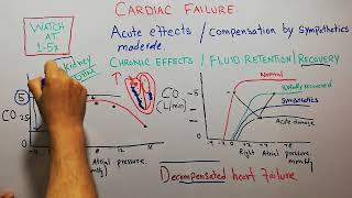 CVS 216  Decompensated heart failure  Compensated heart failure [upl. by Wernher]