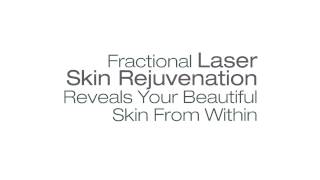 emerge™  Fractional Laser System [upl. by Attena424]