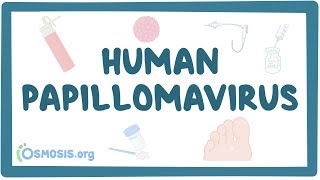 Human papillomavirus or HPV [upl. by Rebeca]