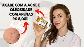 SABONETE DE ENXOFRE GRANADO  Como usar da maneira correta para acabar com a acne e oleosidade [upl. by Aritak]