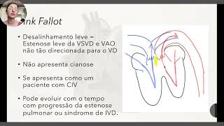 Tetralogia de Fallot  explicação completa [upl. by Arimas980]