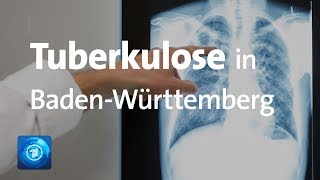 Tuberkulose Schüler und Lehrer in BadenWürttemberg erkrankt [upl. by Eenehs]