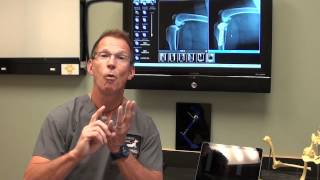 Canine ACL Tears and TPLO Surgery discussed by Dr Bauer DVM DACVS [upl. by Notsirt]