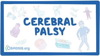 Cerebral palsy CP  causes symptoms diagnosis treatment pathology [upl. by Nylave]