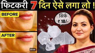 10 रूपए की चीज़ से Skin की सारी मुश्किल आसान  Facial Hair झाइयाँ Hyperpigmentation Wrinkles amp More💕 [upl. by Aisorbma]