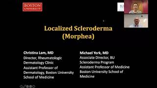 Localized Scleroderma Morphea Christina Lam MD Michael York MD [upl. by Oivlis400]