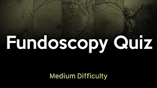 Fundoscopy Quiz Medium Difficulty [upl. by Ahsinnod]