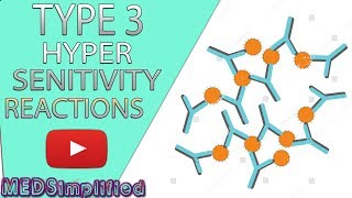 Type 3 Hypersensitivity Made Easy  Immunology [upl. by Llecrad421]