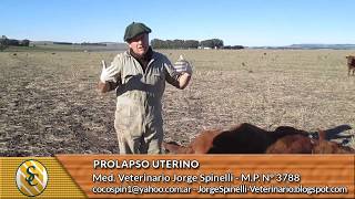 Dr Jorge Spinelli  Prolapso Uterino [upl. by Steinman912]