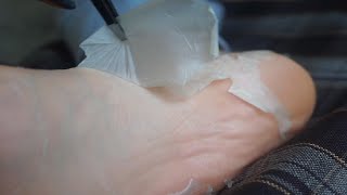 Satisfying foot peeling  How to get rid of dead skin 🦶 Foottherapy  Part 2 [upl. by Notlad558]