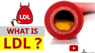 What Is LDL Cholesterol And Why Its Called The BAD Cholesterol  by Dr Sam Robbins [upl. by Biddie]