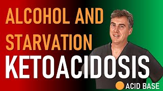 Alcoholic And Starvation Ketoacidosis [upl. by Jeane]