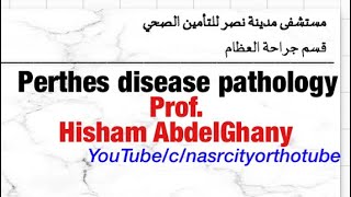 Perthes disease Pathology Prof Hisham AbdelGhany nasrcity online lectures 2020 [upl. by Terrej]