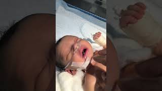 Newborn baby after birth 😌👍 youtubeshorts nursing sumitnicunursingstm newbornbaby viralshort [upl. by Nari]