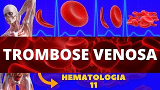 TROMBOSE VENOSA PROFUNDA FORMAÇÃO DE COÁGULO  HEMATOLOGIA TVP [upl. by Airenahs215]