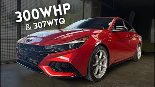 Elantra NLine 300WHP tuned by JV Performance Aramis Otero  DIPR Car Stories 74 [upl. by Ainav]