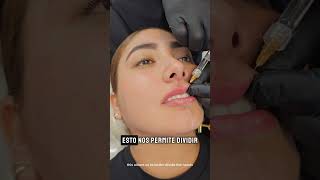 perfilamiento labial [upl. by Sunev]