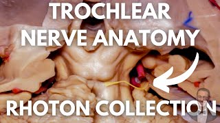 Trochlear Nerve Neuroanatomy  All What You Need to Know  Excpetional Neurosurgical Dissections [upl. by Pride]