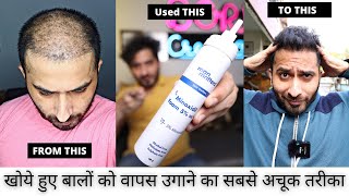 सबसे Powerful medication to REGROW LOST HAIR  Man Matters Minoxidil Foam  Born creator [upl. by Swann712]