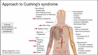 Approach to Cushings syndrome [upl. by Naggem]