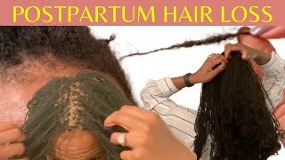 106 Postpartum Hair Loss with Microlocs Sisterlocks [upl. by Cristen]