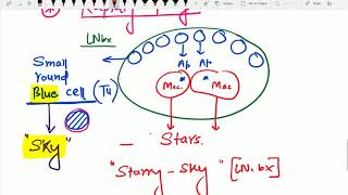 BURKITT s Lymphoma by Dr Devesh Mishra [upl. by Vil318]